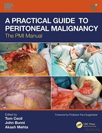 A Practical Guide to Peritoneal Malignancy: The PMI Manual - Tom Cecil [KSIĄŻKA]