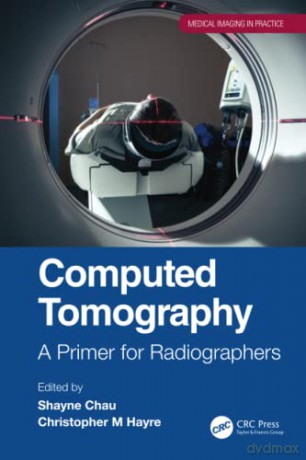 Computed Tomography: A Primer for Radiographers (Medical Imaging in Practice) - Shayne Chau [KSIĄŻKA]