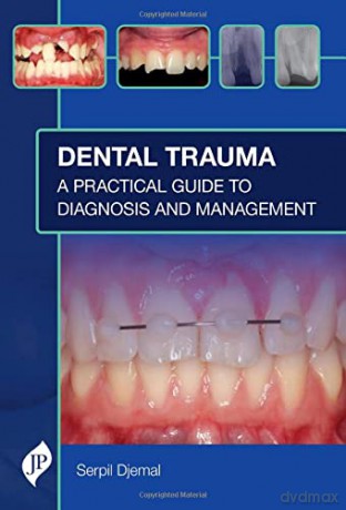 Dental Trauma: A Practical Guide to Diagnosis and Management - Serpil Djemal [KSIĄŻKA]