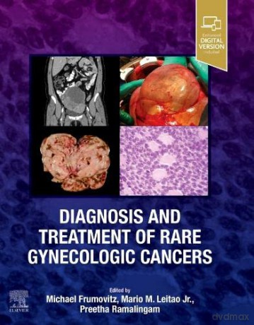 Diagnosis and Treatment of Rare Gynecologic Cancers - Michael Frumovitz MD PhD [KSIĄŻKA]
