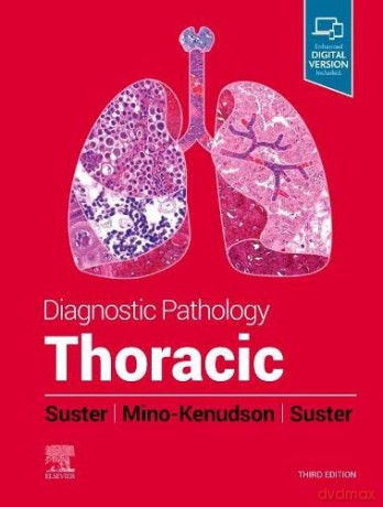 Diagnostic Pathology: Thoracic - Saul Suster MD [KSIĄŻKA]