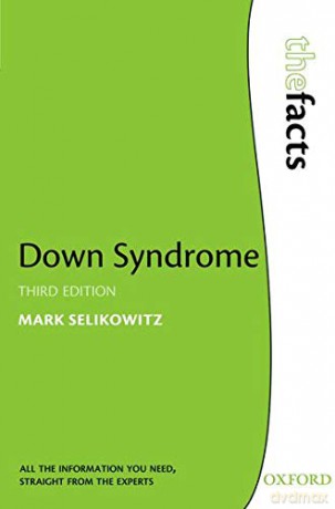 Down Syndrome (The Facts) - Mark Selikowitz [KSIĄŻKA]