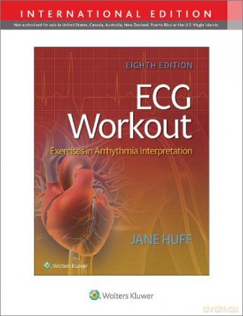 ECG Workout: Exercises in Arrythmia Interpretation - Jane Huff [KSIĄŻKA]