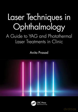 Laser Techniques in Ophthalmology: A Guide to YAG and Photothermal Laser Treatments in Clinic - Anita Prasad [KSIĄŻKA]