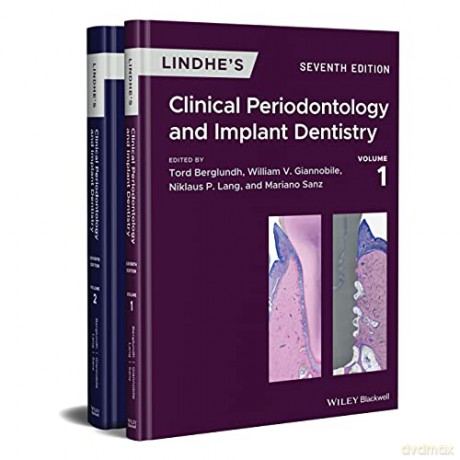 Lindhe's Clinical Periodontology and Implant Dentistry: 2 Volume Set - Tord Berglundh [KSIĄŻKA]