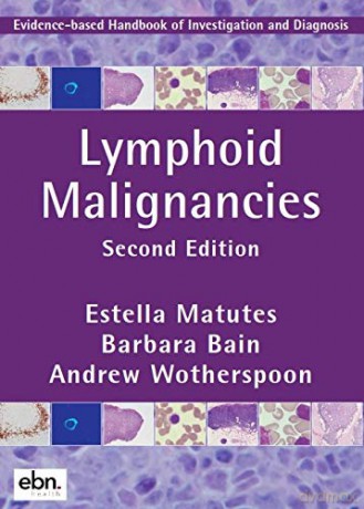 Lymphoid Malignancies: Evidence-based Handbook of Investigation and Diagnosis - Andrew Wotherspoon [KSIĄŻKA]