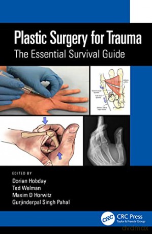 Plastic Surgery for Trauma: The Essential Survival Guide - Dorian Hobday [KSIĄŻKA]