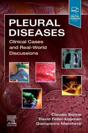 Pleural Diseases: Clinical Cases and Real-World Discussions - Claudio Sorino MD PhD [KSIĄŻKA]