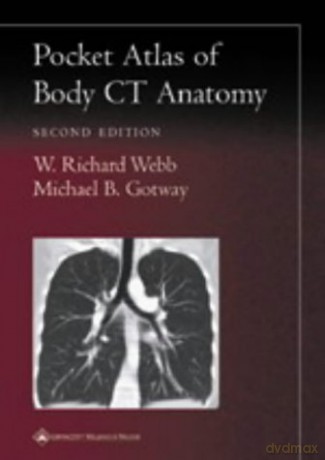 Pocket Atlas of Body CT Anatomy (Radiology Pocket Atlas Series) - W. Richard Webb [KSIĄŻKA]