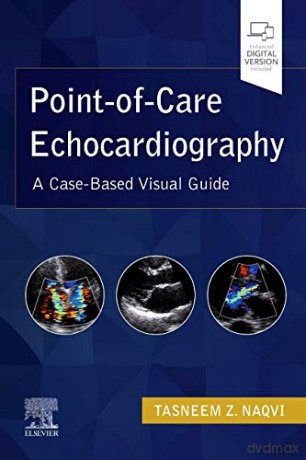 Point-of-Care Echocardiography: A Clinical Case-Based Visual Guide - Tasneem Z. Naqvi MD FRCP (Lon.UK) MMM FASE FACC [KSIĄŻKA]