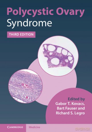 Polycystic Ovary Syndrome - Gabor T. Kovacs [KSIĄŻKA]