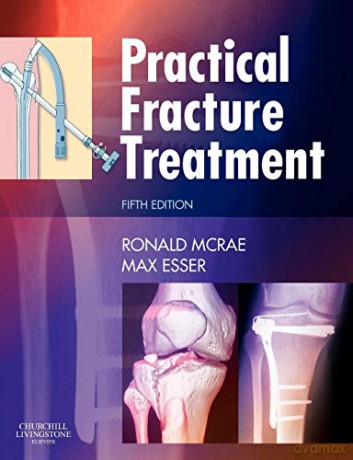 Practical Fracture Treatment, Fith Edition - Ronald McRae [KSIĄŻKA]