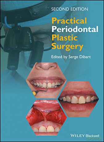 Practical Periodontal Plastic Surgery - Serge Dibart [KSIĄŻKA]
