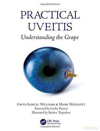 Practical Uveitis: Understanding the Grape - Gwyn Samuel Williams [KSIĄŻKA]