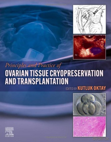 Principles and Practice of Ovarian Tissue Cryopreservation and Transplantation - Kutluk Oktay [KSIĄŻKA]