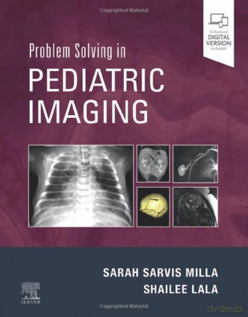 Problem Solving in Pediatric Imaging - Shailee Lala [KSIĄŻKA]