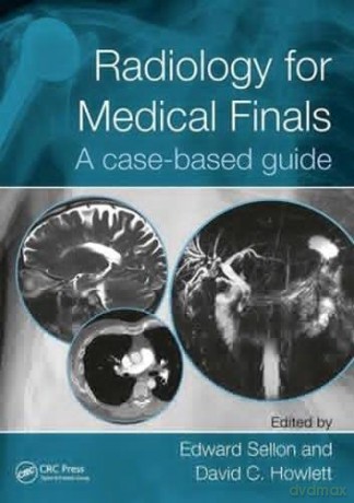 Radiology for Medical Finals: A case-based guide - Lt Col Edward Sellon [KSIĄŻKA]