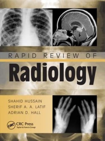 Rapid Review of Radiology (Medical Rapid Review Series) - Shahid Hussain [KSIĄŻKA]