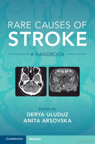 Rare Causes of Stroke: A Handbook - Anita Arsovska [KSIĄŻKA]