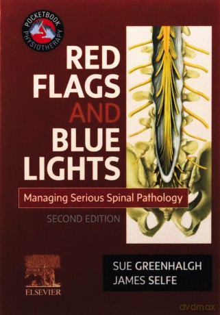 Red Flags and Blue Lights: Managing Serious Spinal Pathology, 2e (Physiotherapy Pocketbooks) - Sue Greenhalgh MA GD Phys FCSP [KSIĄŻKA]