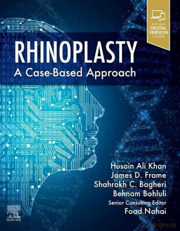 Rhinoplasty: a Case-based approach - Behnam Bohluli DMD [KSIĄŻKA]