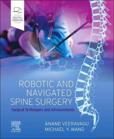 Robotic and Navigated Spine Surgery: Surgical Techniques and Advancements - Anand Veeravagu [KSIĄŻKA]