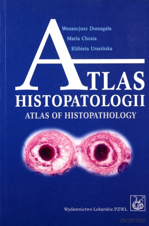 Atlas histopatologii - Tajemniczy świat chorych komórek człowieka - Domagała [KSIĄŻKA]