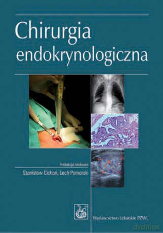 Chirurgia endokrynologiczna - Cichoń [KSIĄŻKA]