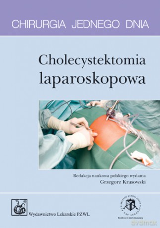 Chirurgia jednego dnia - Cholecystektomia laparoskopowa - McWhinnie [KSIĄŻKA]