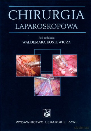 Chirurgia laparoskopowa - Kostewicz [KSIĄŻKA]