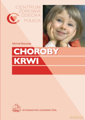 Choroby krwi - Matysiak [KSIĄŻKA]