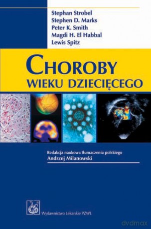 Choroby wieku dziecięcego - Strobel [KSIĄŻKA]