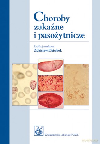 Choroby zakaźne i pasożytnicze - Dziubek [KSIĄŻKA]