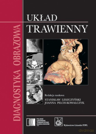 Diagnostyka obrazowa - Układ trawienny - Leszczyński [KSIĄŻKA]