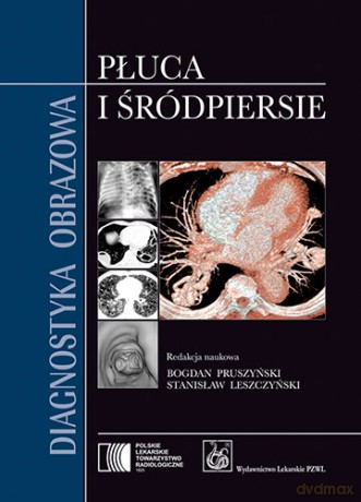 Diagnostyka obrazowa.Płuca i śródpiersie - Pruszyński [KSIĄŻKA]