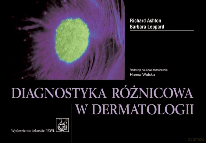 Diagnostyka różnicowa w dermatologii - Ashton [KSIĄŻKA]