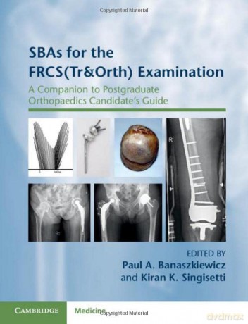 SBAs for the FRCS(Tr&Orth) Examination: A Companion to Postgraduate Orthopaedics Candidate's Guide - Paul A. Banaszkiewicz [KSIĄŻKA]