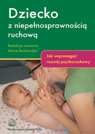 Dziecko z niepełnosprawnością ruchową - Jak wspomagać rozwój psychoruchowy - Borkowska [KSIĄŻKA]