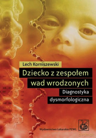 Dziecko z zespołem wad wrodzonych - Diagnostyka dysmorfologiczna - Korniszewski [KSIĄŻKA]