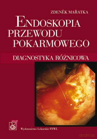 Endoskopia przewodu pokarmowego - Diagnostyka różnicowa - Maratka [KSIĄŻKA]