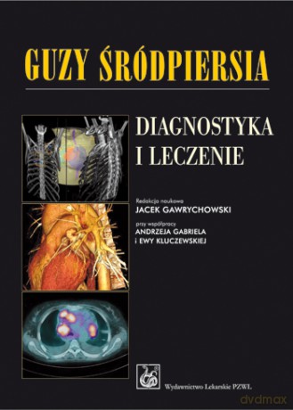 Guzy śródpiersia - Diagnostyka i leczenie [KSIĄŻKA]