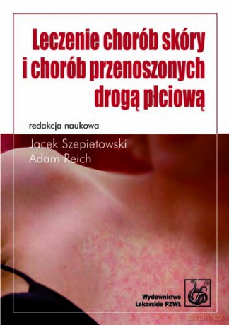 Leczenie chorób skóry i chorób przenoszonych drogą płciową - Szepietowski [KSIĄŻKA]