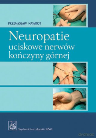 Neuropatie uciskowe nerwów kończyny górnej - Nawrot [KSIĄŻKA]