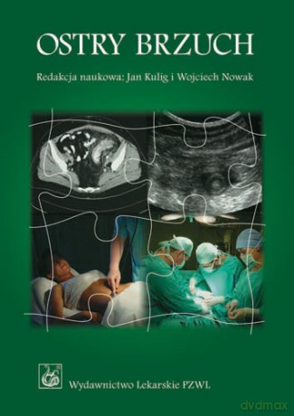 Ostry brzuch - Podręcznik dla lekarzy i studentów - Kulig [KSIĄŻKA]