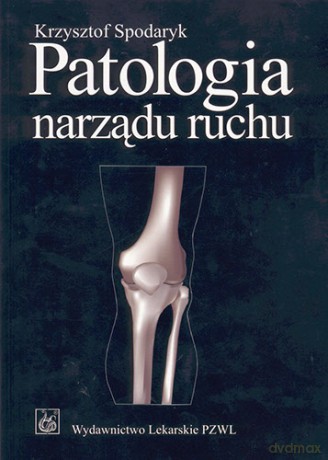 Patologia narządu ruchu - Spodaryk [KSIĄŻKA]