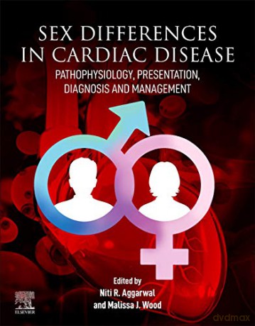 Sex differences in Cardiac Diseases: Pathophysiology, Presentation, Diagnosis and Management - Niti R. Aggarwal [KSIĄŻKA]