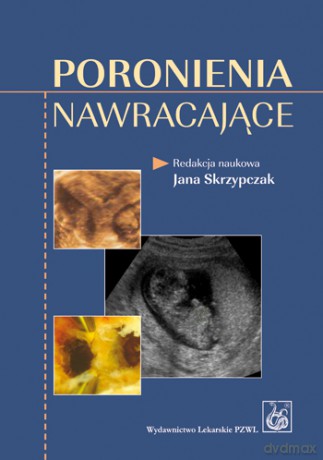 Poronienia nawracające - Skrzypczak [KSIĄŻKA]