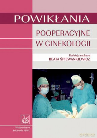 Powikłania pooperacyjne w ginekologii - Śpiewankiewicz [KSIĄŻKA]