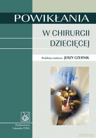 Powikłania w chirurgii dziecięcej - Czernik [KSIĄŻKA]