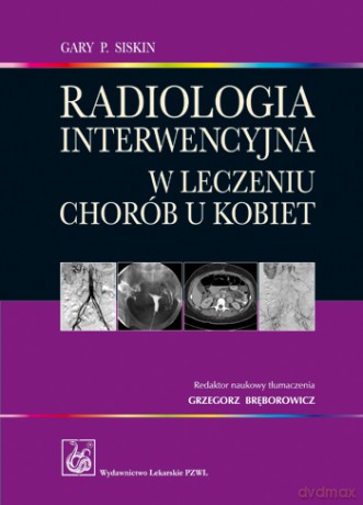 Radiologia interwencyjna w leczeniu chorób u kobiet - Siskin [KSIĄŻKA]
